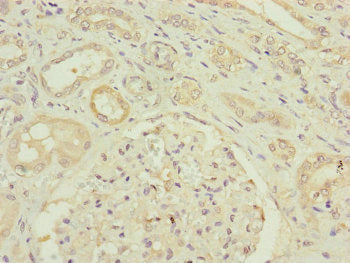 Immunohistochemistry of paraffin-embedded human kidney tissue using HAUS8 Antibody at dilution of 1:100Rabbit anti-Human HAUS8 Polyclonal Antibody
