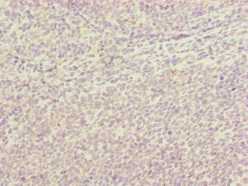 Immunohistochemistry of paraffin-embedded human tonsil tissue using HAUS8 Antibody at dilution of 1:100Rabbit anti-Human HAUS8 Polyclonal Antibody