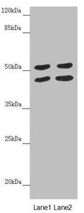 Western blot | All lanes: HAUS8 antibody at 5.18 μg/ml | Lane 1: Hela whole cell lysate | Lane 2: A549 whole cell lysate | Secondary | Goat polyclonal to rabbit IgG at 1/10000 dilution | Predicted band size: 45, 39 kDa | Observed band size: 45, 52 kDaRabbit anti-Human HAUS8 Polyclonal Antibody