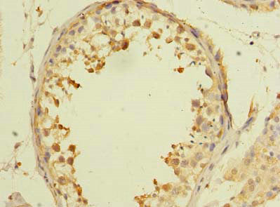 Immunohistochemistry of paraffin-embedded human testis tissue using AARSD1 Antibody at dilution of 1:100