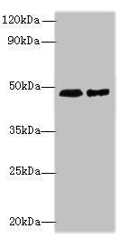 Western blot  | All lanes: AARSD1 antibody at 0.8µg/ml  | Lane 1: Hela whole cell lysate  | Lane 2: U251 whole cell lysate  | Secondary  | Goat polyclonal to rabbit IgG at 1/10000 dilution  | Predicted band size: 46, 59, 66 kDa  | Observed band size: 46 kDa