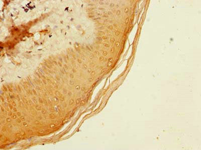 Immunohistochemistry of paraffin-embedded human skin tissue using ADAT1 Antibody at dilution of 1:100Rabbit anti-Human ADAT1 Polyclonal Antibody