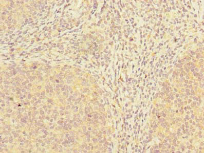 Immunohistochemistry of paraffin-embedded human tonsil tissue using ADAT1 Antibody at dilution of 1:100Rabbit anti-Human ADAT1 Polyclonal Antibody