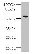 Western blot  | All lanes: ADAT1 antibody at 6µg/ml + MDA-MB-231 whole cell lysate  | Secondary  | Goat polyclonal to rabbit IgG at 1/10000 dilution  | Predicted band size: 56, 39 kDa  | Observed band size: 56 kDa