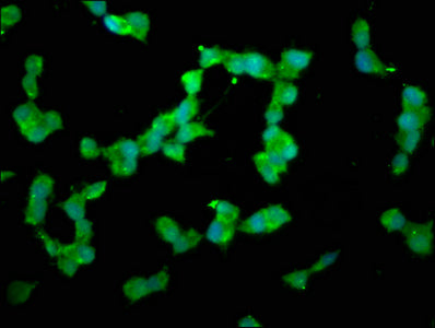 Immunofluorescence staining of SH-SY5Y cells with DUSP26 Antibody at 1:200, counter-stained with DAPI. The cells were fixed in 4% formaldehyde, permeabilized using 0.2% Triton X-100 and blocked in 10% normal Goat Serum. The cells were then incubated with the antibody overnight at 4°C. The secondary antibody was Alexa Fluor 488-congugated AffiniPure Goat Anti-Rabbit IgG(H+L).