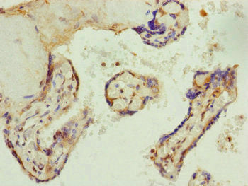 Immunohistochemistry of paraffin-embedded human placenta tissue using AP1M1 Antibody at dilution of 1:100Rabbit anti-Human AP1M1 Polyclonal Antibody