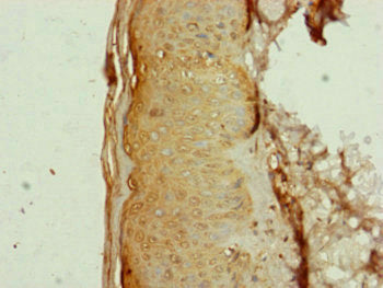 Immunohistochemistry of paraffin-embedded human skin tissue using AP1M1 Antibody at dilution of 1:100Rabbit anti-Human AP1M1 Polyclonal Antibody