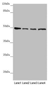 Western blot  | All lanes: AP1M1 antibody at 1.43µg/ml  | Lane 1: A375 whole cell lysate  | Lane 2: Jurkat whole cell lysate  | Lane 3: Hela whole cell lysate  | Lane 4: HepG2 whole cell lysate  | Secondary  | Goat polyclonal to rabbit IgG at 1/10000 dilution  | Predicted band size: 49, 50 kDa  | Observed band size: 49 kDaRabbit anti-Human AP1M1 Polyclonal Antibody
