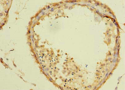 Immunohistochemistry of paraffin-embedded human testis tissue using TSGA10 Antibody at dilution of 1:100Rabbit anti-Human TSGA10 Polyclonal Antibody