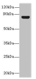 Western blot  | All lanes: TSGA10 antibody at 1.5µg/ml + U251 whole cell lysate  | Secondary  | Goat polyclonal to rabbit IgG at 1/10000 dilution  | Predicted band size: 82, 35 kDa  | Observed band size: 82 kDaRabbit anti-Human TSGA10 Polyclonal Antibody