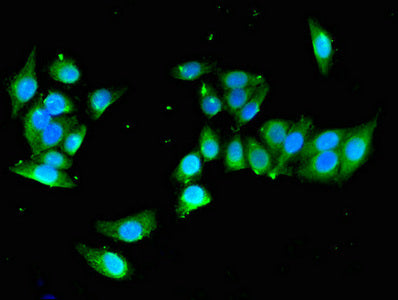 Immunofluorescent analysis of PC-3 cells using YIPF3 Antibody at dilution of 1:100 and Alexa Fluor 488-congugated AffiniPure Goat Anti-Rabbit IgG(H+L)Rabbit anti-Human YIPF3 Polyclonal Antibody
