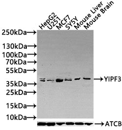 Western Blot | Positive WB detected in: Mouse heart tissue, Mouse liver tissue, Mouse brain tissue, Mouse stomach tissue | All lanes: YIPF3 antibody at 3μg/ml | Secondary | Goat polyclonal to rabbit IgG at 1/50000 dilution | Predicted band size: 39 kDa | Observed band size: 39 kDaRabbit anti-Human YIPF3 Polyclonal Antibody