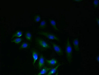 Immunofluorescent analysis of A549 cells using SLC6A16 Antibody at dilution of 1:100 and Alexa Fluor 488-congugated AffiniPure Goat Anti-Rabbit IgG(H+L)Rabbit anti-Human SLC6A16 Polyclonal Antibody