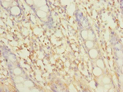 Immunohistochemistry of paraffin-embedded human colon tissue using the antibody at dilution of 1:100Rabbit anti-Human SLC6A16 Polyclonal Antibody
