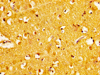 IHC image of NAT10 Antibody diluted at 1:300 and staining in paraffin-embedded human brain tissue performed on a Leica BondTM system. After dewaxing and hydration, antigen retrieval was mediated by high pressure in a citrate buffer (pH 6.0). Section was blocked with 10% normal goat serum 30min at RT. Then primary antibody (1% BSA) was incubated at 4°C overnight. The primary is detected by a biotinylated secondary antibody and visualized using an HRP conjugated SP system.