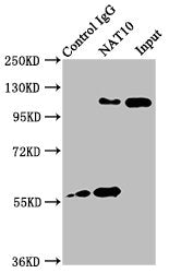 Immunoprecipitating NAT10 in Hela whole cell lysate | Lane 1: Rabbit control IgG instead of NAT10 Antibody in Hela whole cell lysate. | For western blotting, a HRP-conjugated Protein G antibody was used as the secondary antibody (1/2000) | Lane 2: NAT10 Antibody (6μg) + Hela whole cell lysate (1mg) | Lane 3: Hela whole cell lysate (20μg)