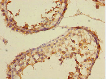 Immunohistochemistry of paraffin-embedded human testis tissue using CSRNP2 Antibody at dilution of 1:100Rabbit anti-Human CSRNP2 Polyclonal Antibody
