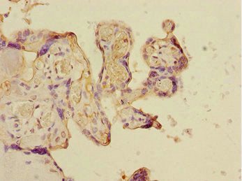 Immunohistochemistry of paraffin-embedded human placenta tissue using CSRNP2 Antibody at dilution of 1:100Rabbit anti-Human CSRNP2 Polyclonal Antibody