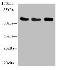 Western blot  | All lanes: CSRNP2 antibody at 2.71µg/ml  | Lane 1: Mouse heart tissue  | Lane 2: HepG2 whole cell lysate  | Lane 3: Mouse brain tissue  | Secondary  | Goat polyclonal to rabbit IgG at 1/10000 dilution  | Predicted band size: 60 kDa  | Observed band size: 60 kDaRabbit anti-Human CSRNP2 Polyclonal Antibody