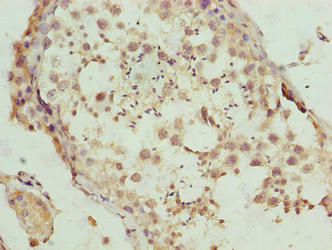 Immunohistochemistry of paraffin-embedded human testis tissue using DEFB129 Antibody at dilution of 1:100Rabbit anti-Human DEFB129 Polyclonal Antibody