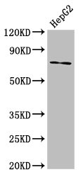 Western Blot  | Positive WB detected in: HepG2 whole cell lysate  | All lanes: ABCG5 antibody at 8.7µg/ml  | Secondary  | Goat polyclonal to rabbit IgG at 1/50000 dilution  | Predicted band size: 73, 29 kDa  | Observed band size: 73 kDa