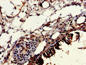 Immunohistochemistry of paraffin-embedded human lung tissue using VPS16 Antibody at dilution of 1:100Rabbit anti-Human VPS16 Polyclonal Antibody