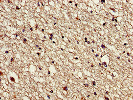 Immunohistochemistry of paraffin-embedded human brain tissue using VPS16 Antibody at dilution of 1:100Rabbit anti-Human VPS16 Polyclonal Antibody