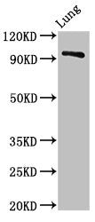 Western Blot | Positive WB detected in: Rat lung tissue | All lanes: VPS16 antibody at 3μg/ml | Secondary | Goat polyclonal to rabbit IgG at 1/50000 dilution | Predicted band size: 95, 79 kDa | Observed band size: 95 kDaRabbit anti-Human VPS16 Polyclonal Antibody