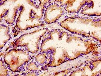 IHC image of ACBD3 Antibody diluted at 1:500 and staining in paraffin-embedded human prostate tissue performed on a Leica BondTM system. After dewaxing and hydration, antigen retrieval was mediated by high pressure in a citrate buffer (pH 6.0). Section was blocked with 10% normal goat serum 30min at RT. Then primary antibody (1% BSA) was incubated at 4°C overnight. The primary is detected by a biotinylated secondary antibody and visualized using an HRP conjugated ABC system.