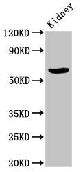 Western Blot | Positive WB detected in: Rat kidney tissue | All lanes: ACBD3 antibody at 7μg/ml | Secondary | Goat polyclonal to rabbit IgG at 1/50000 dilution | Predicted band size: 61 kDa | Observed band size: 61 kDa