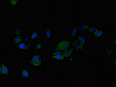 Immunofluorescent analysis of HepG2 cells using ALG2 Antibody at dilution of 1:100 and Alexa Fluor 489-congugated AffiniPure Goat Anti-Rabbit IgG(H+L)Rabbit anti-Human ALG2 Polyclonal Antibody