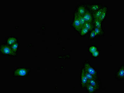 Immunofluorescent analysis of HepG2 cells using SLC32A1 Antibody at dilution of 1:100 and Alexa Fluor 488-congugated AffiniPure Goat Anti-Rabbit IgG(H+L)Rabbit anti-Human SLC32A1 Polyclonal Antibody