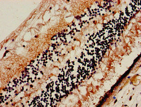 Immunohistochemistry of paraffin-embedded human eye tissue using SLC32A1 Antibody at dilution of 1:100Rabbit anti-Human SLC32A1 Polyclonal Antibody