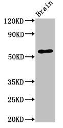 Western Blot | Positive WB detected in: Mouse brain tissue | All lanes: SLC32A1 antibody at 3.4μg/ml | Secondary | Goat polyclonal to rabbit IgG at 1/50000 dilution | Predicted band size: 58 kDa | Observed band size: 58 kDaRabbit anti-Human SLC32A1 Polyclonal Antibody