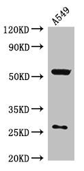 Western Blot  | Positive WB detected in: A549 whole cell lysate  | All lanes: CIAO3 antibody at 2.7µg/ml  | Secondary  | Goat polyclonal to rabbit IgG at 1/50000 dilution  | Predicted band size: 54, 27, 43 kDa  | Observed band size: 54, 27 kDaRabbit anti-Human CIAO3 Polyclonal Antibody