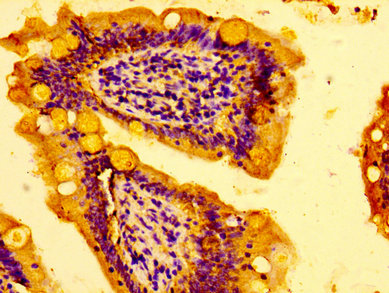 IHC image of the antibody diluted at 1:100 and staining in paraffin-embedded human small intestine tissue performed on a Leica BondTM system. After dewaxing and hydration, antigen retrieval was mediated by high pressure in a citrate buffer (pH 6.0). Section was blocked with 10% normal goat serum 30min at RT. Then primary antibody (1% BSA) was incubated at 4°C overnight. The primary is detected by a biotinylated secondary antibody and visualized using an HRP conjugated SP system.