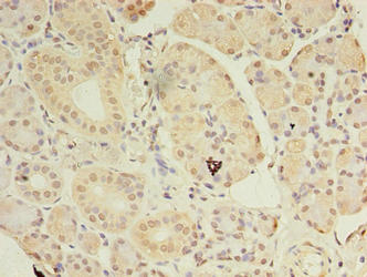 Immunohistochemistry of paraffin-embedded human pancreatic tissue using ASB8 Antibody at dilution of 1:100Rabbit anti-Human ASB8 Polyclonal Antibody