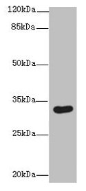 Western blot  | All lanes: ASB8 antibody at 1µg/ml + Human placenta tissue  | Secondary  | Goat polyclonal to rabbit IgG at 1/10000 dilution  | Predicted band size: 32 kDa  | Observed band size: 32 kDa