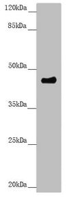 Western blot  | All lanes: PLEKHA1 antibody at 3.11µg/ml + A549 whole cell lysate  | Secondary  | Goat polyclonal to rabbit IgG at 1/10000 dilution  | Predicted band size: 46, 39 kDa  | Observed band size: 46 kDaRabbit anti-Human PLEKHA1 Polyclonal Antibody
