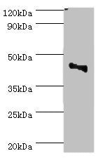 Western blot | All lanes: CBX8 antibody at 2μg/ml + Jurkat whole cell lysate | Secondary | Goat polyclonal to rabbit IgG at 1/10000 dilution | Predicted band size: 43 kDa | Observed band size: 43 kDa
