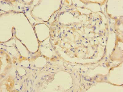 Immunohistochemistry of paraffin-embedded human kidney tissue using GDPD2 Antibody at dilution of 1:100Rabbit anti-Human GDPD2 Polyclonal Antibody