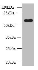 Western blot  | All lanes: GDPD2 antibody at 1.5µg/ml + A431 whole cell lysate  | Secondary  | Goat polyclonal to rabbit IgG at 1/10000 dilution  | Predicted band size: 62, 53, 67 kDa  | Observed band size: 62 kDaRabbit anti-Human GDPD2 Polyclonal Antibody