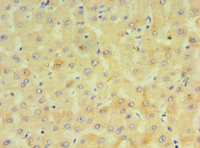 Immunohistochemistry of paraffin-embedded human liver tissue using CYP4F12 Antibody at dilution of 1:100Rabbit anti-Human CYP4F12 Polyclonal Antibody