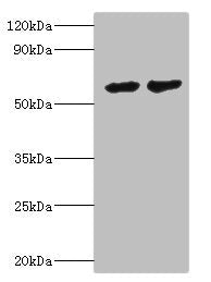 Western blot | All lanes: CYP4F12 antibody at 6μg/ml | Lane 1: Mouse small intestine tissue | Lane 2: Rat liver tissue | Secondary | Goat polyclonal to rabbit IgG at 1/10000 dilution | Predicted band size: 61, 12 kDa | Observed band size: 61 kDaRabbit anti-Human CYP4F12 Polyclonal Antibody