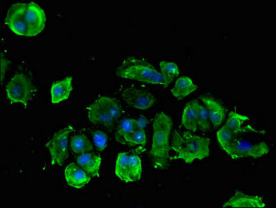 Immunofluorescent analysis of MCF-7 cells using PLCB1 Antibody at dilution of 1:100 and Alexa Fluor 488-congugated AffiniPure Goat Anti-Rabbit IgG(H+L)Rabbit anti-Human PLCB1 Polyclonal Antibody