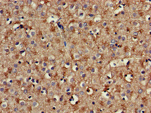 Immunohistochemistry of paraffin-embedded human brain tissue using PLCB1 Antibody at dilution of 1:100Rabbit anti-Human PLCB1 Polyclonal Antibody