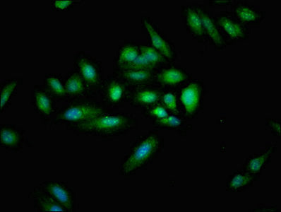 Immunofluorescent analysis of Hela cells using CYLD Antibody at dilution of 1:100 and Alexa Fluor 488-congugated AffiniPure Goat Anti-Rabbit IgG(H+L)