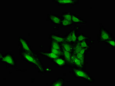 Immunofluorescent analysis of Hela cells using ASH1L Antibody at dilution of 1:100 and Alexa Fluor 488-congugated AffiniPure Goat Anti-Rabbit IgG(H+L)Rabbit anti-Human ASH1L Polyclonal Antibody