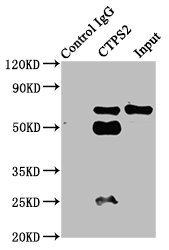 Immunoprecipitating CTPS2 in HepG2 whole cell lysate  | Lane 1: Rabbit control IgG instead of the antibody in HepG2 whole cell lysate. For western blotting, a HRP-conjugated Protein G antibody was used as the secondary antibody (1/2000)  | Lane 2: the antibody (6µg) + HepG2 whole cell lysate (500µg)  | Lane 3: HepG2 whole cell lysate (20µg)Rabbit anti-Human CTPS2 Polyclonal Antibody