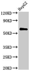 Western Blot  | Positive WB detected in: HepG2 whole cell lysate  | All lanes: CTPS2 antibody at 2.8µg/ml  | Secondary  | Goat polyclonal to rabbit IgG at 1/50000 dilution  | Predicted band size: 66 kDa  | Observed band size: 66 kDaRabbit anti-Human CTPS2 Polyclonal Antibody